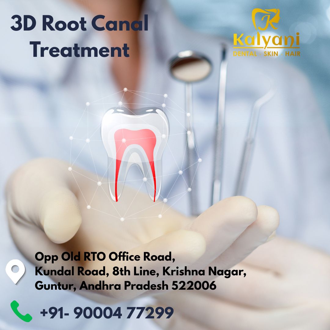 3D Root Canal Treatment