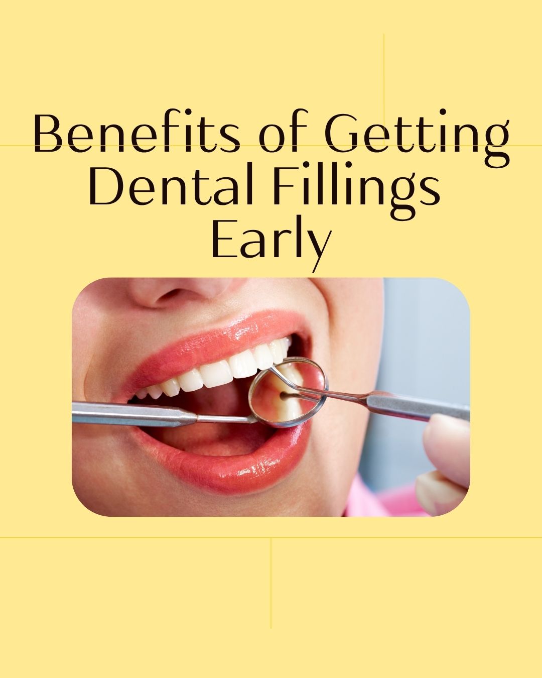 benefits-of-getting-dental-fillings-early