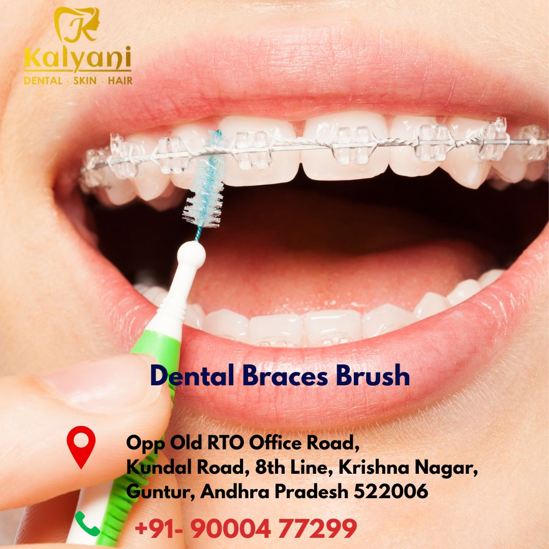 Dental Braces Brush
