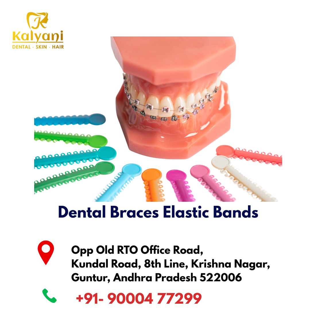 Dental Braces Elastic Bands