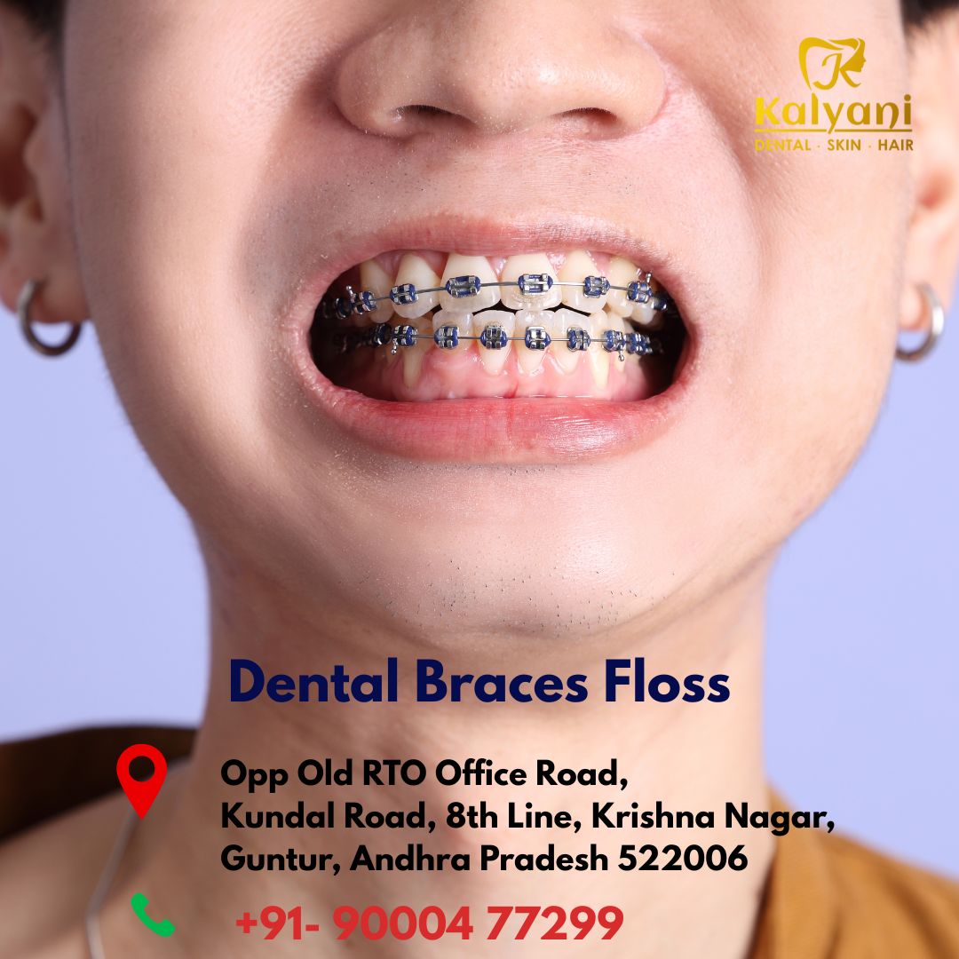 dental braces floss