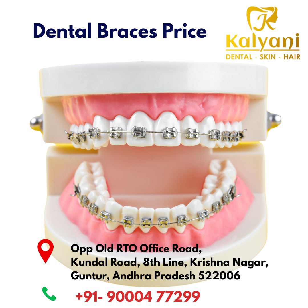 Dental Braces Price