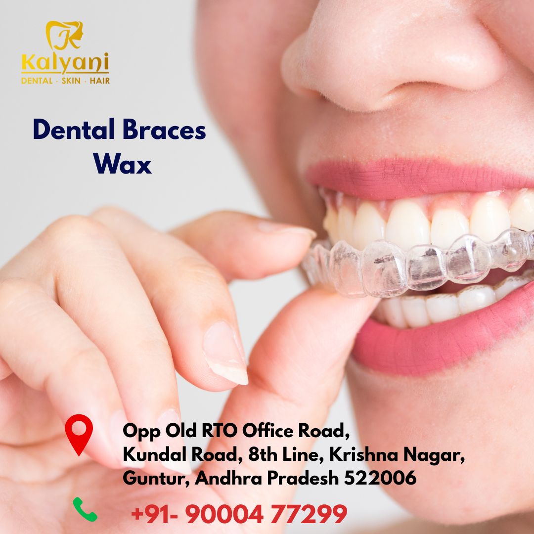Dental Braces Wax