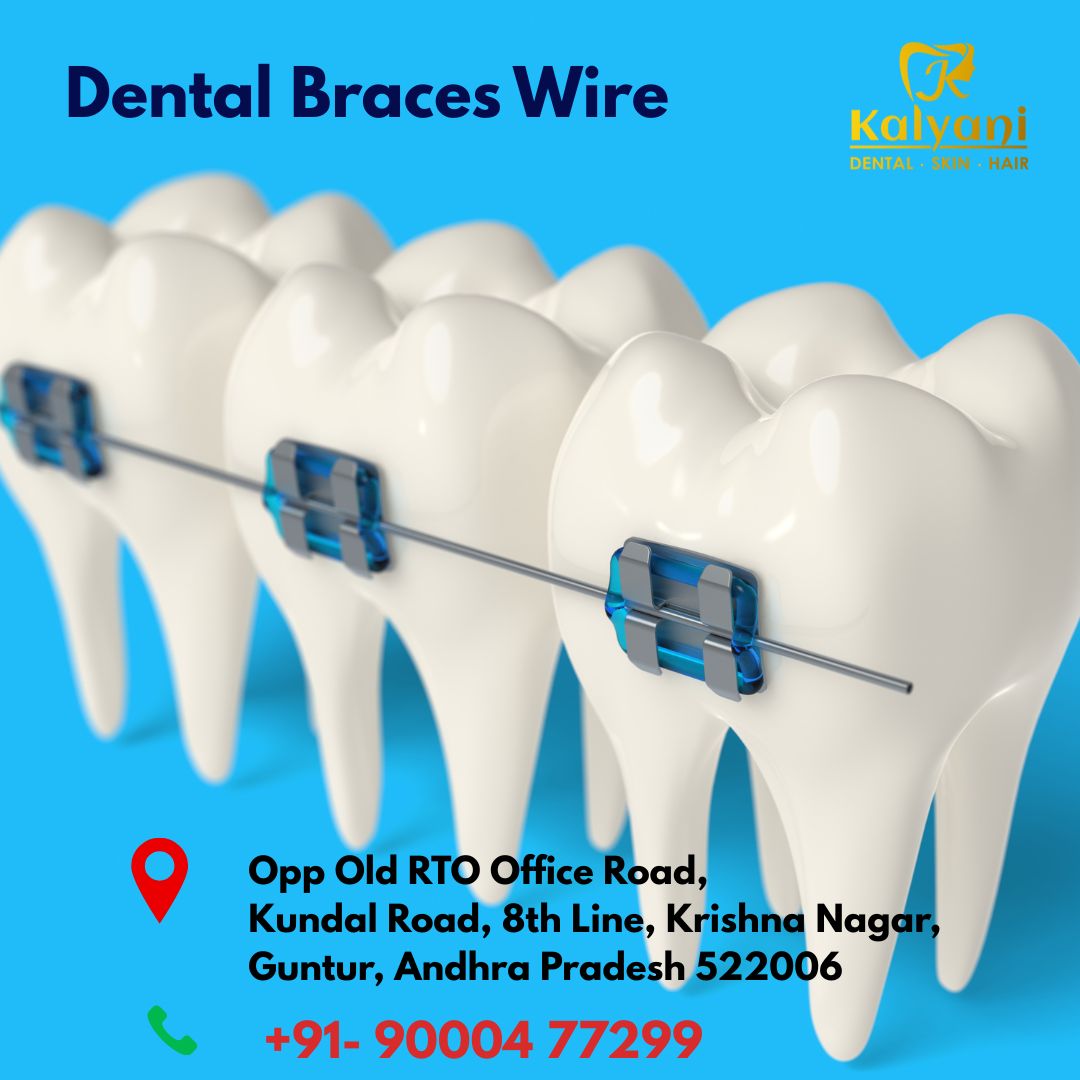 Dental Braces Wire