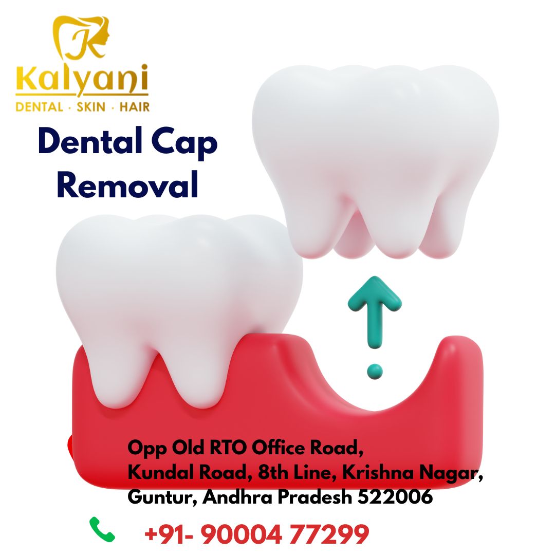 Root Canal Treatment Procedure