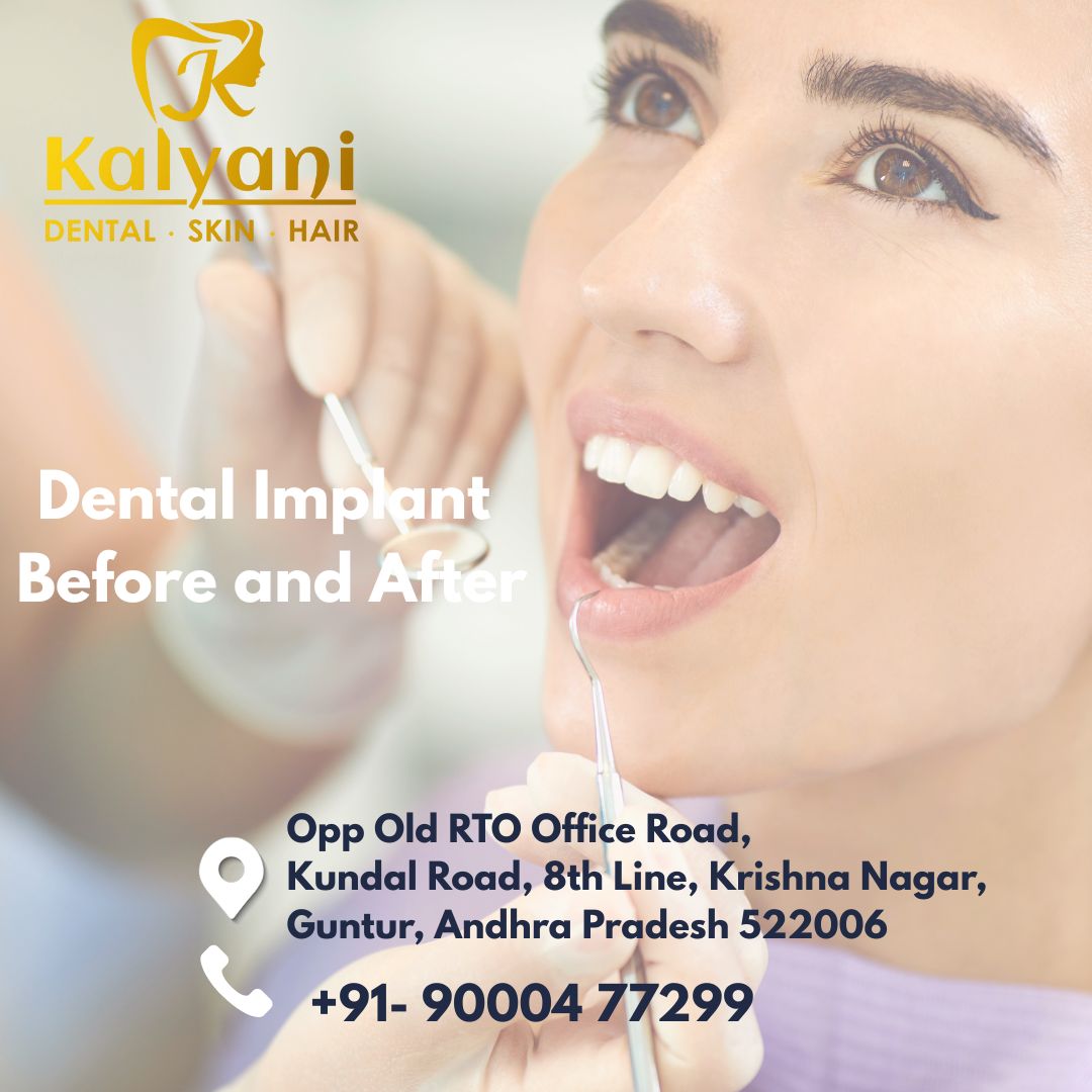 dental implant before and after
