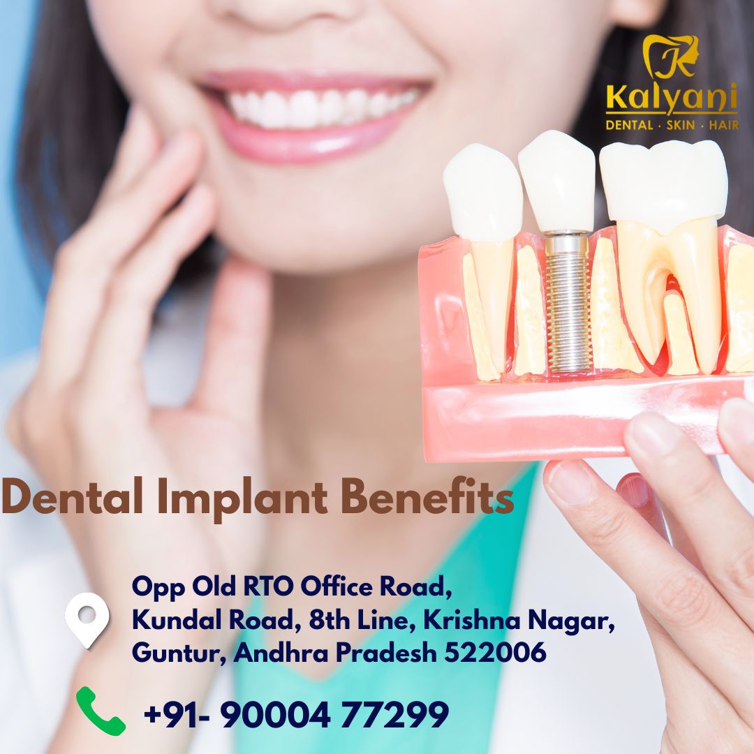dental implant benefits
