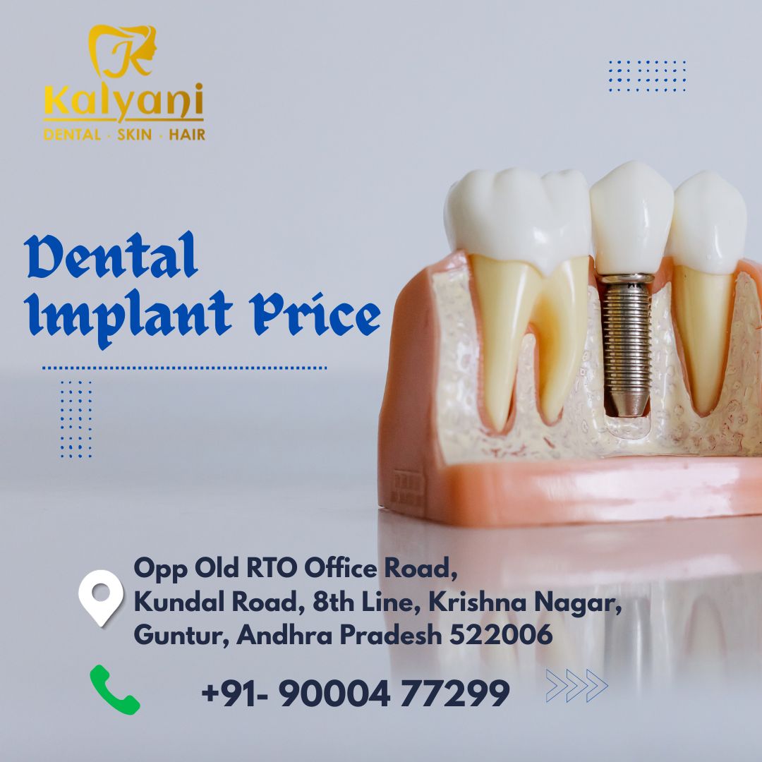dental implant price