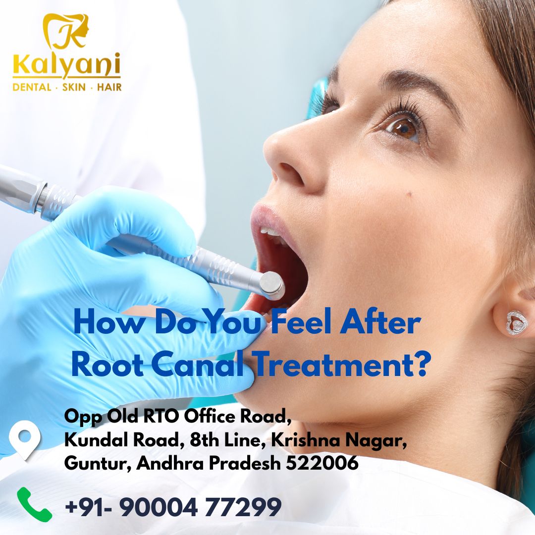 How Do You Feel After Root Canal Treatment? 
