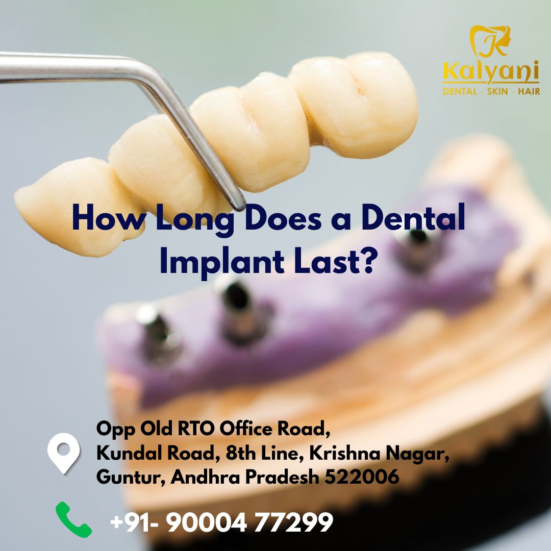 how long does a dental implant last