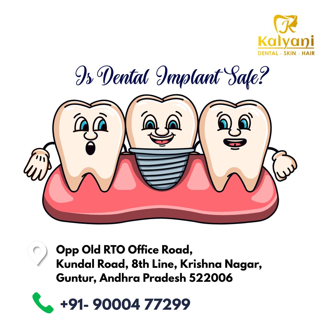 is dental implant safe