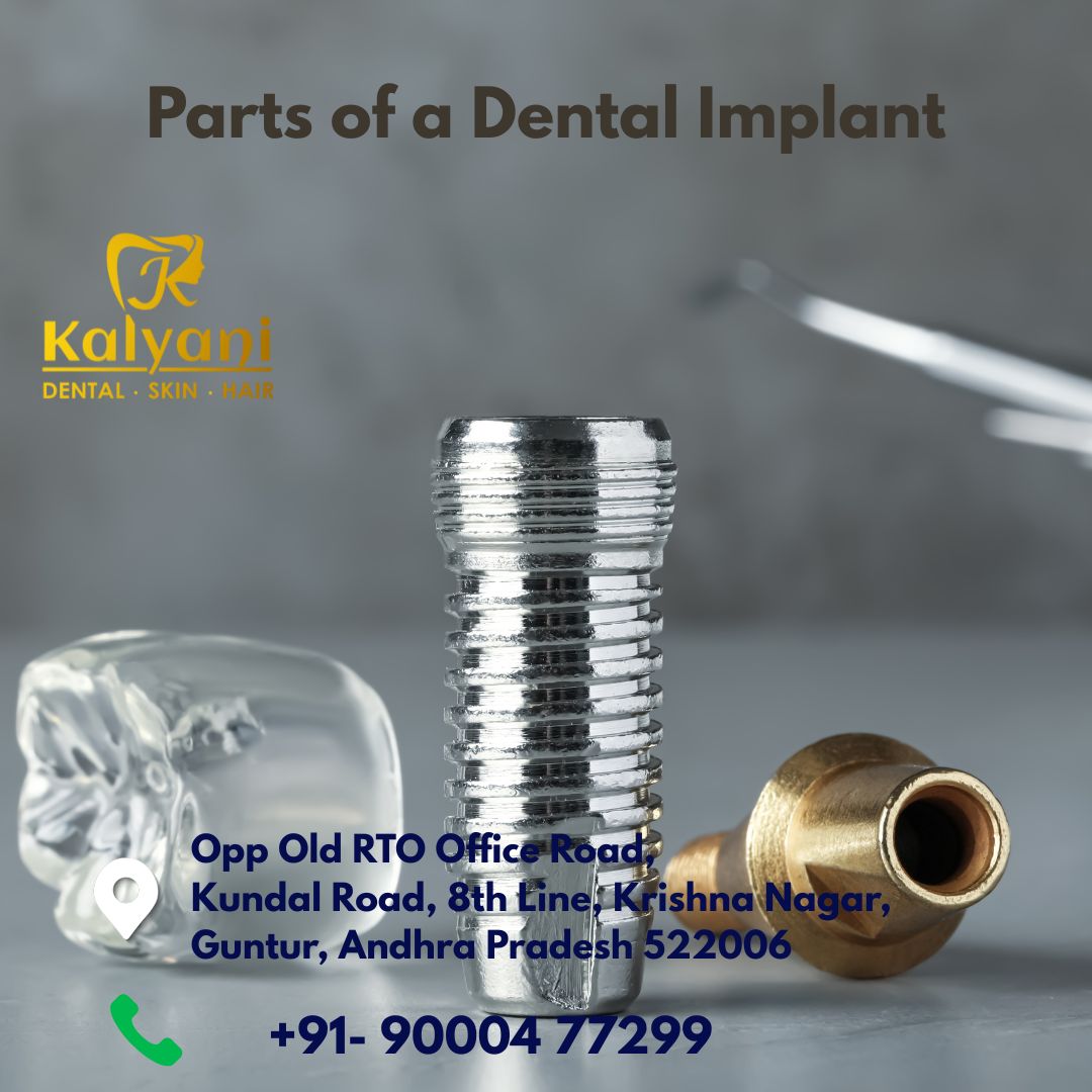 parts of a dental implant