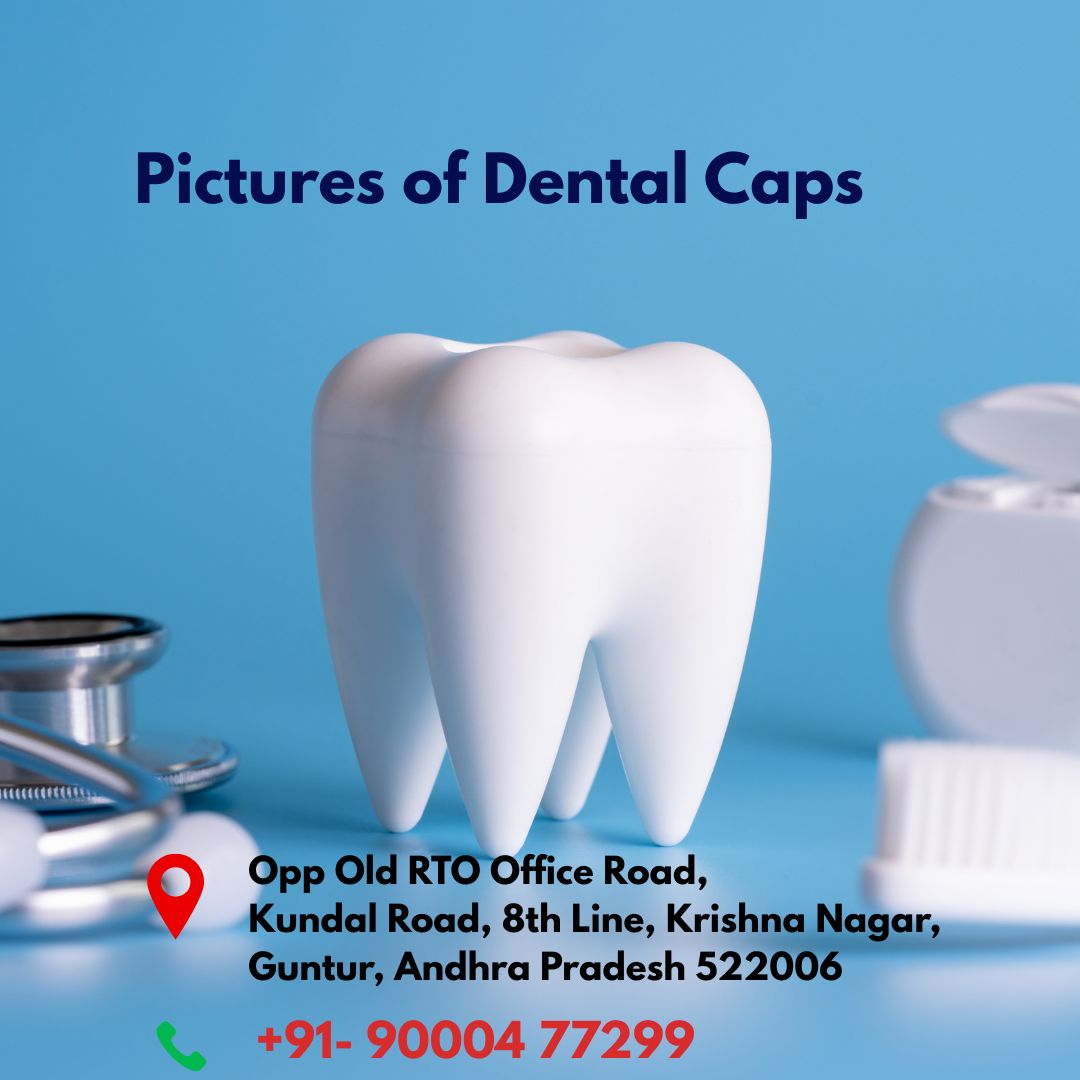 Root Canal Treatment Procedure