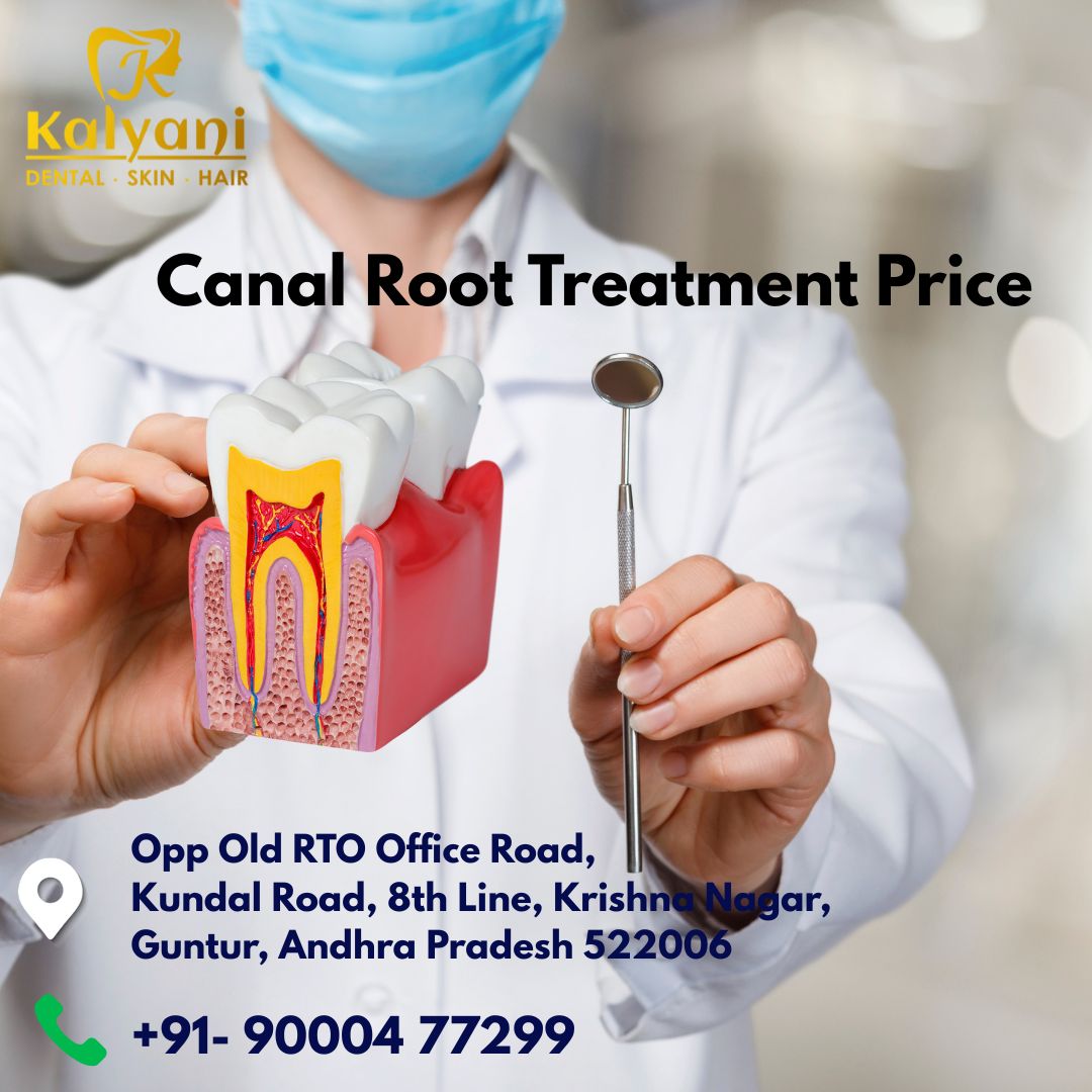 Root Canal Treatment Price