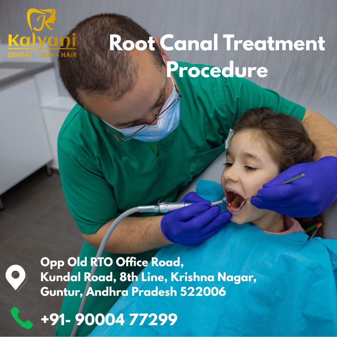 Root Canal Treatment Procedure