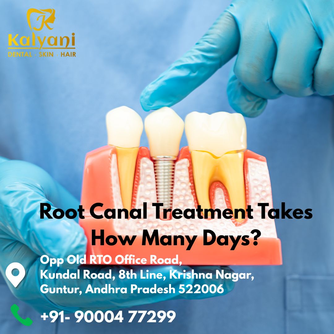 Root Canal Treatment Takes How Many Days